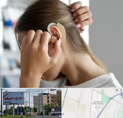 فروش اقساطی سمعک در فاز یک اندیشه