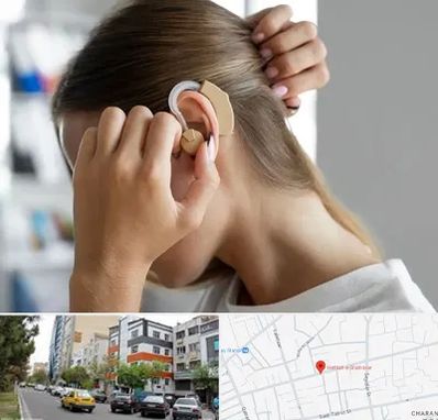 فروش اقساطی سمعک در هفده شهریور تبریز