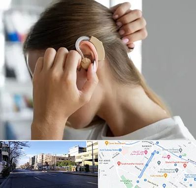 فروش اقساطی سمعک در خیابان ملاصدرا شیراز 