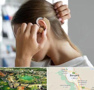 فروش اقساطی سمعک در بروجرد