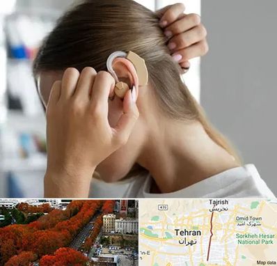 فروش اقساطی سمعک در ولیعصر 