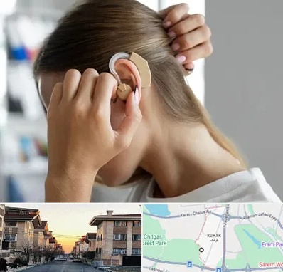 فروش اقساطی سمعک در کوهک