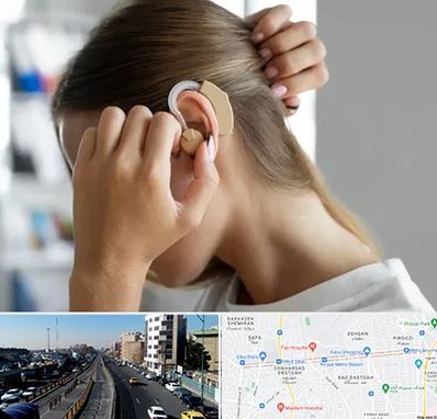 فروش اقساطی سمعک در پیروزی 