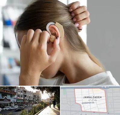 فروش اقساطی سمعک در خیابان جمالزاده