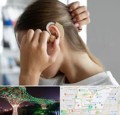 فروش اقساطی سمعک در منطقه 3 تهران 