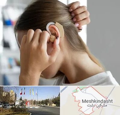 فروش اقساطی سمعک در مشکین دشت