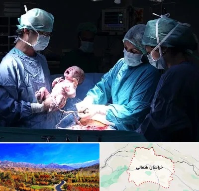 جراح سزارین در خراسان شمالی