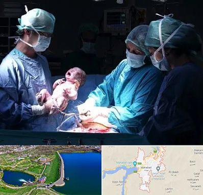 جراح سزارین در مهاباد