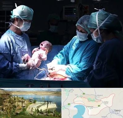 جراح سزارین در شبستر