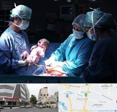 جراح سزارین در بلوار فردوس