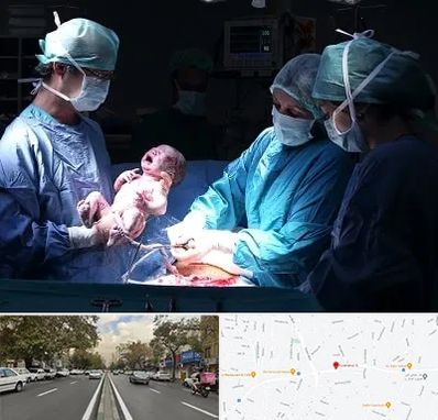 جراح سزارین در دولت