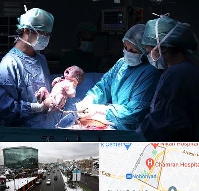 جراح سزارین در اقدسیه