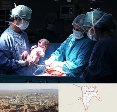 جراح سزارین در اسفراین