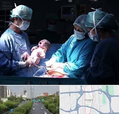 جراح سزارین در توانیر