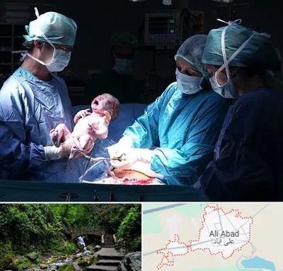 جراح سزارین در علی آباد کتول