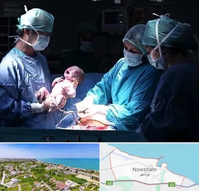 جراح سزارین در نوشهر