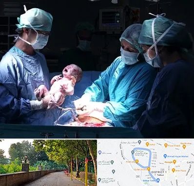 جراح سزارین در فلکه گاز رشت