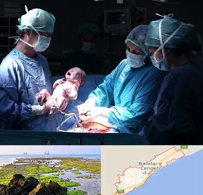 جراح سزارین در بندرلنگه