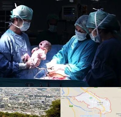 جراح سزارین در یاسوج