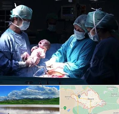 جراح سزارین در مرند