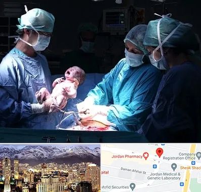 جراح سزارین در جردن