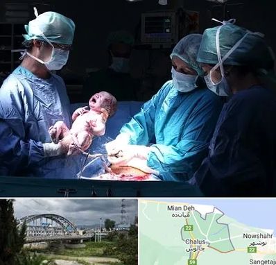 جراح سزارین در چالوس