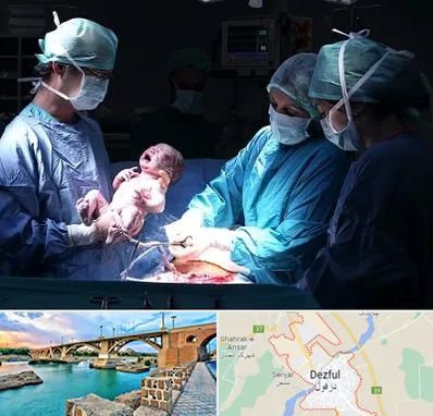جراح سزارین در دزفول
