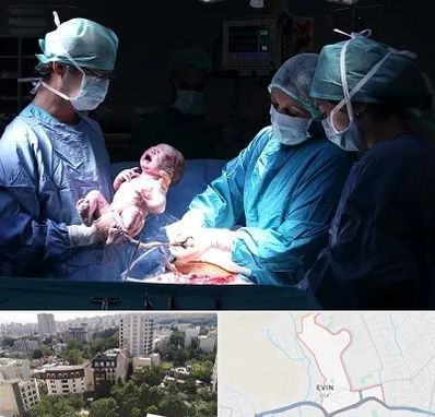 جراح سزارین در اوین