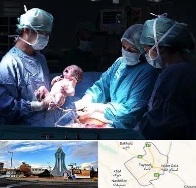 جراح سزارین در تایباد