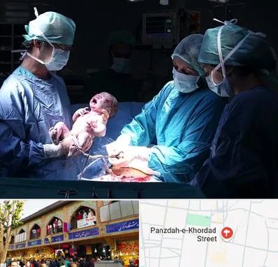 جراح سزارین در 15 خرداد