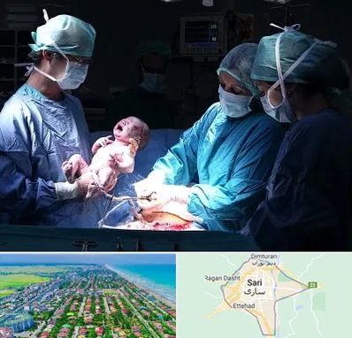جراح سزارین در ساری