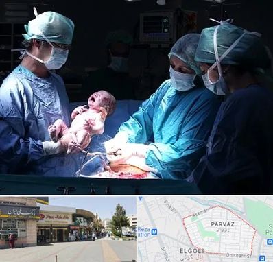 جراح سزارین در پرواز تبریز