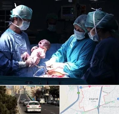جراح سزارین در خطیب تبریز