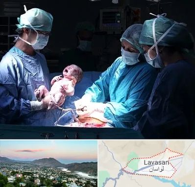 جراح سزارین در لواسان