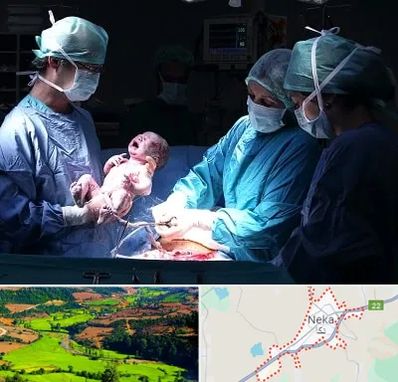 جراح سزارین در نکا