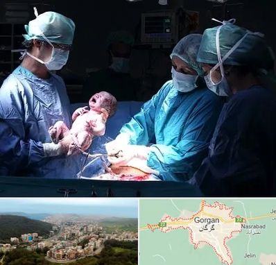 جراح سزارین در گرگان