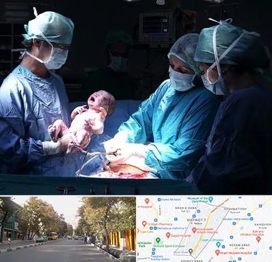 جراح سزارین در شریعتی