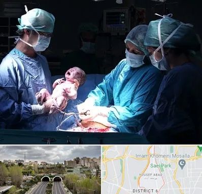 جراح سزارین در یوسف آباد