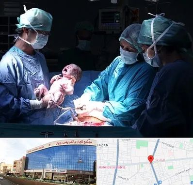 جراح سزارین در نصف راه تبریز