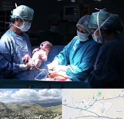 جراح سزارین در رودهن