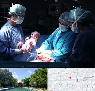 جراح سزارین در هشت بهشت اصفهان