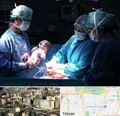 جراح سزارین در مرزداران