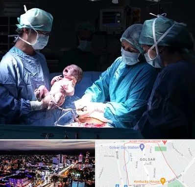 جراح سزارین در گلسار رشت