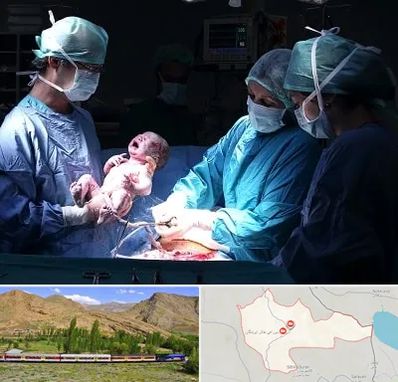 جراح سزارین در خاش