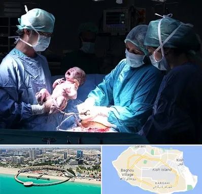 جراح سزارین در کیش
