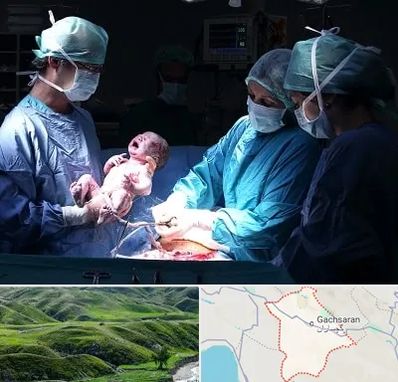 جراح سزارین در گچساران