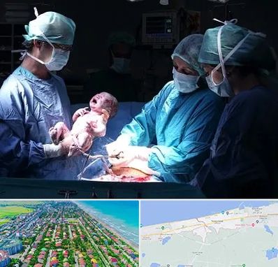 جراح سزارین در فریدونکنار