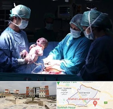 جراح سزارین در حکیمیه