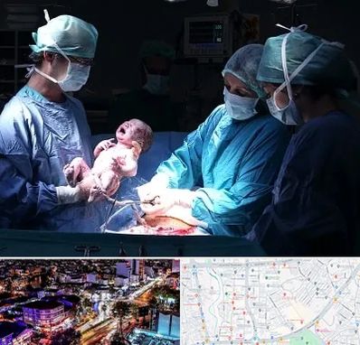 جراح سزارین در منظریه رشت