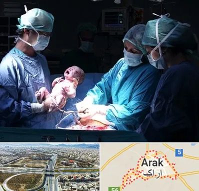 جراح سزارین در اراک